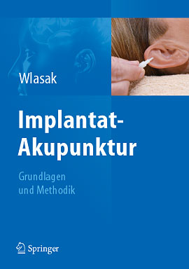 Das Buch zur Implantat-Akupunktur